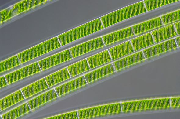 Strands of Spirogyra under the microscope showing the spiral chloroplasts  (Image courtesy of Wikimedia Commons}.
